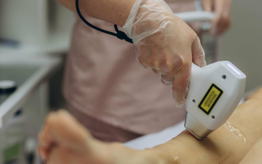 Nouvelle législation en matière d’épilation laser