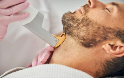 Épilation laser du visage à Toulouse : ce qu’il faut savoir