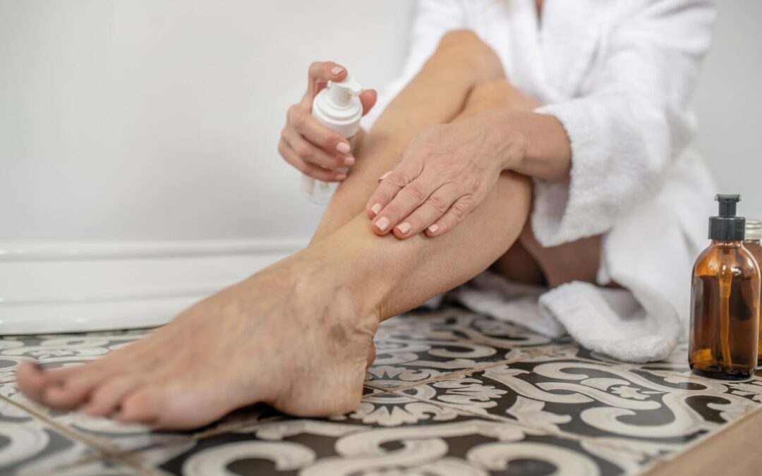 Éviter les irritations après une épilation laser à Toulouse